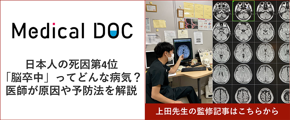 日本人の死因第4位「脳卒中」ってどんな病気？ 医師が原因や予防法を解説