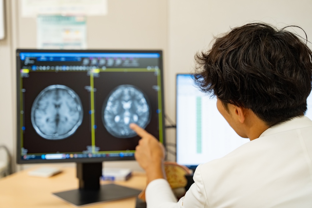 脳神経外科とは？